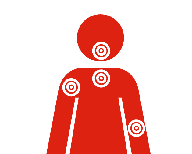 Upper body discomfort